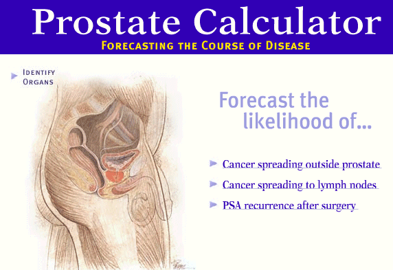 prostate cancer prognosis calculator